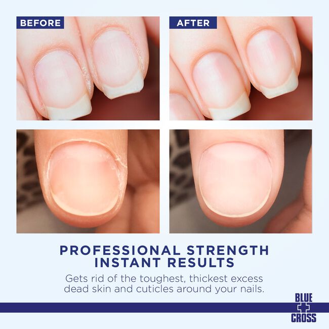 Cuticle Remover Liquid