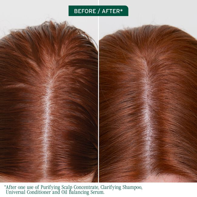 Scalp Sync Oil Balancing Serum for Oily Scalp