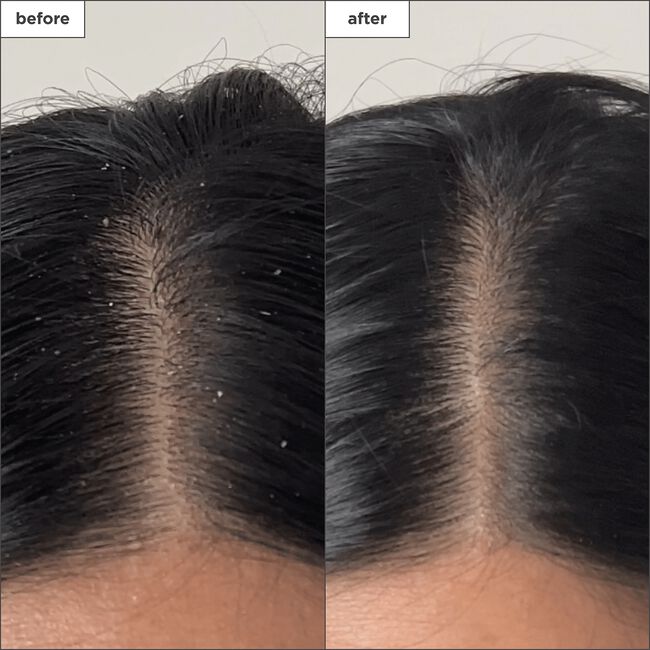 Scalp Revival Charcoal & Tea Tree Buildup Detox Spray