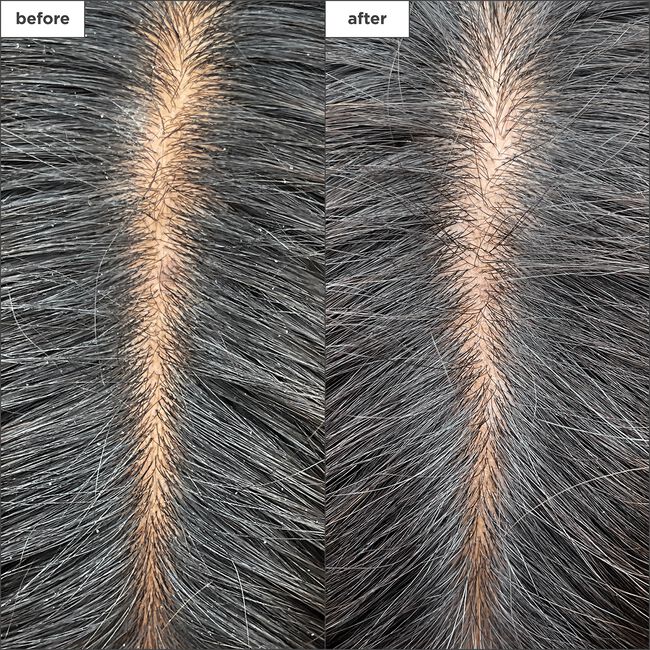 Scalp Revival Charcoal & Tea Tree Cooling Hydration Scalp Mask