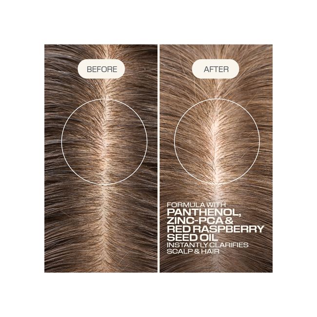Dualsenses Scalp Specialist Clarifying Shampoo