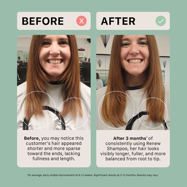 Renew Healing Shampoo Treatment
