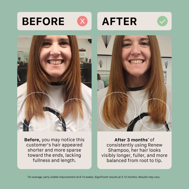 Renew Shampoo Treatment Duo