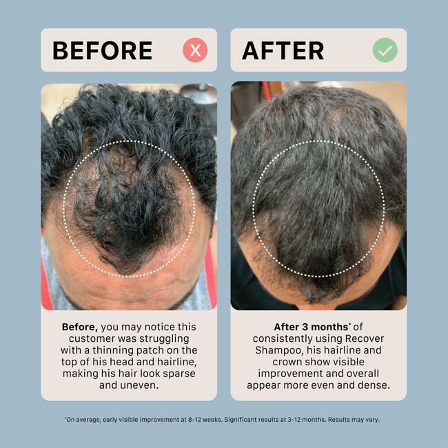 Recover Shampoo & Conditioning System for Men