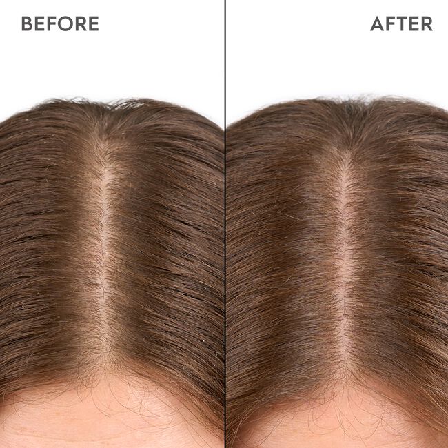 Moisturizing Scalp Drops