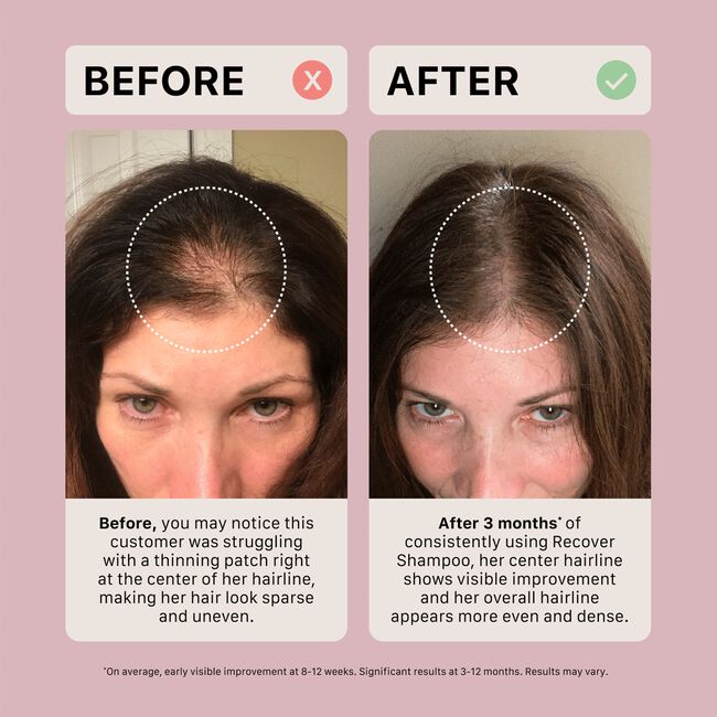 Recover Shampoo & Conditioning System for Women