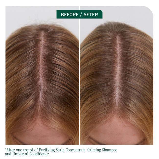 Scalp Sync Purifying Concentrate