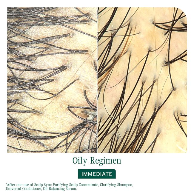 Scalp Sync Oil Balancing Serum for Oily Scalp