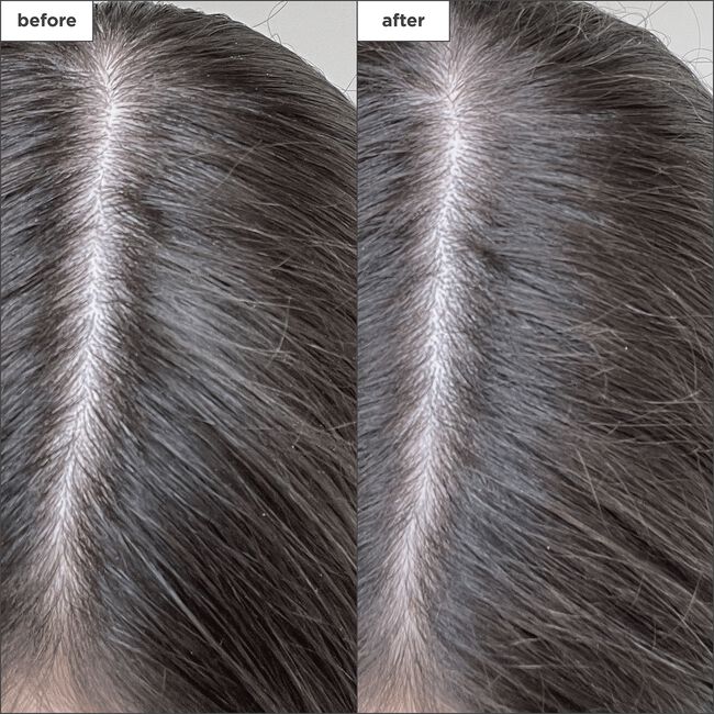 Scalp Revival Charcoal & Biotin Dry Shampoo