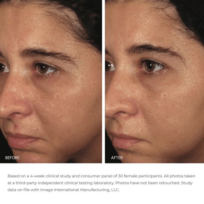 ORMEDIC Balancing Bio-Peptide Creme